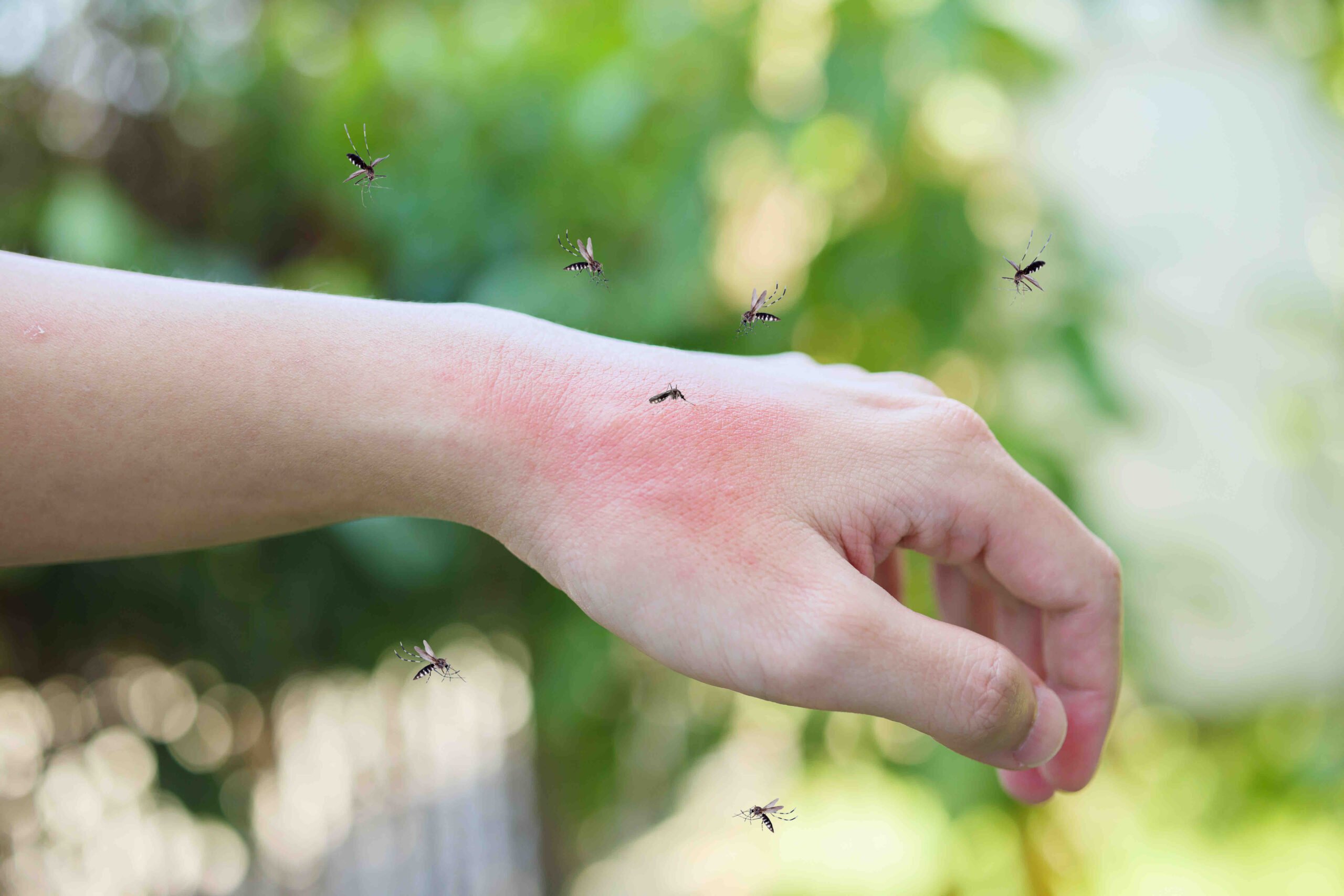 infected insect bite treatment - streatham at Westbury Chemist