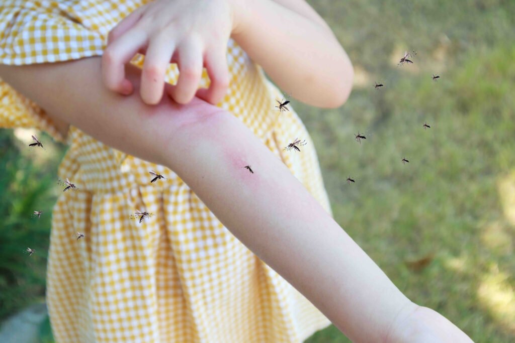 infected insect bites - free nhs consultations