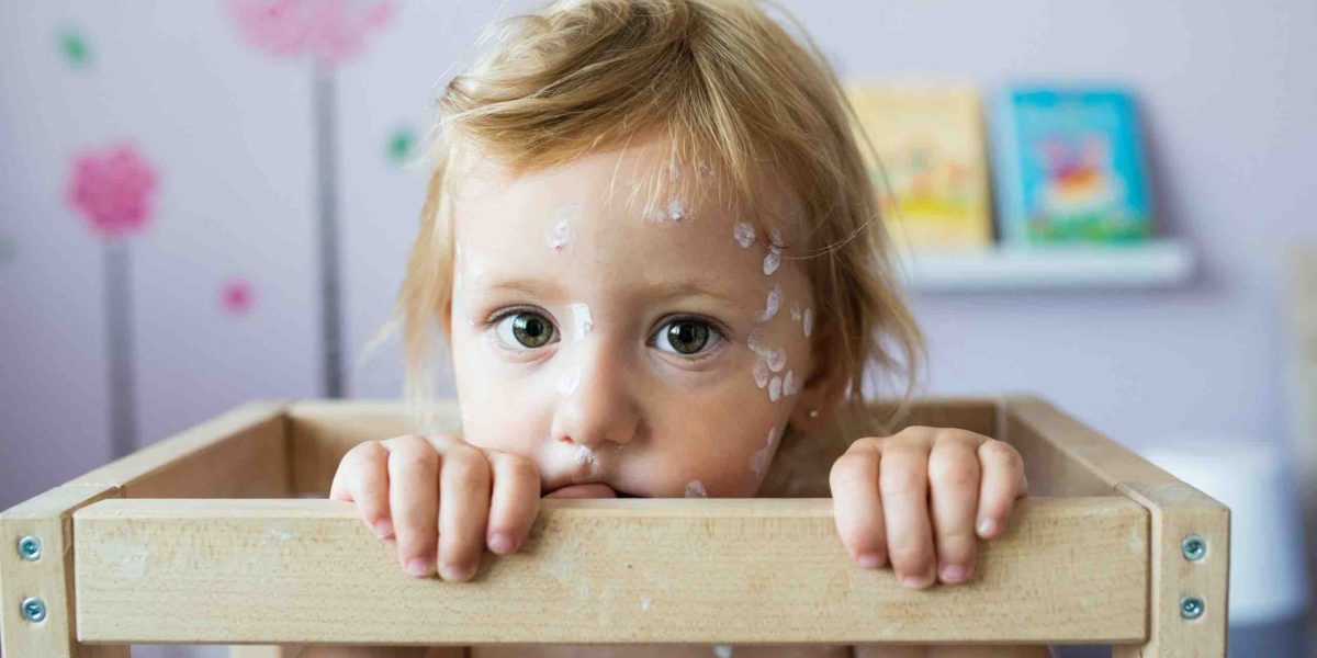 chickenpox vaccine in streatham feature image